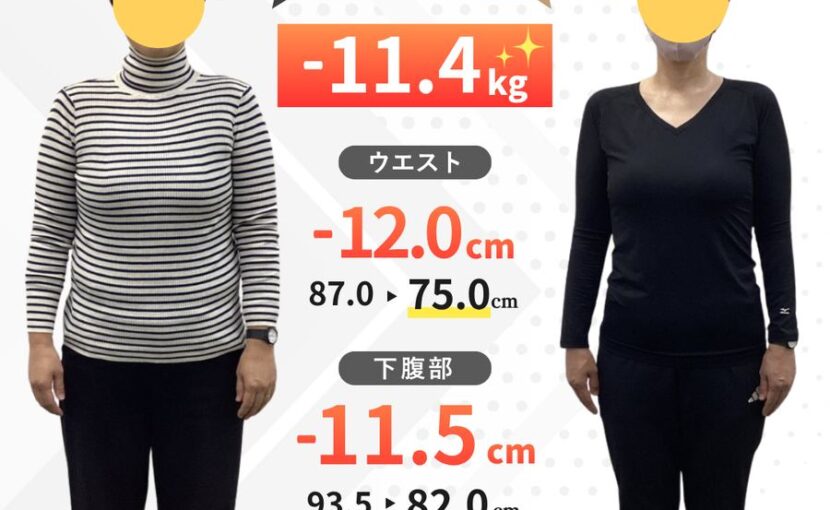 40代女性・3ヶ月のビフォーアフター（正面）ウエスト87.0cmから75.0cm、内臓脂肪レベル15から8