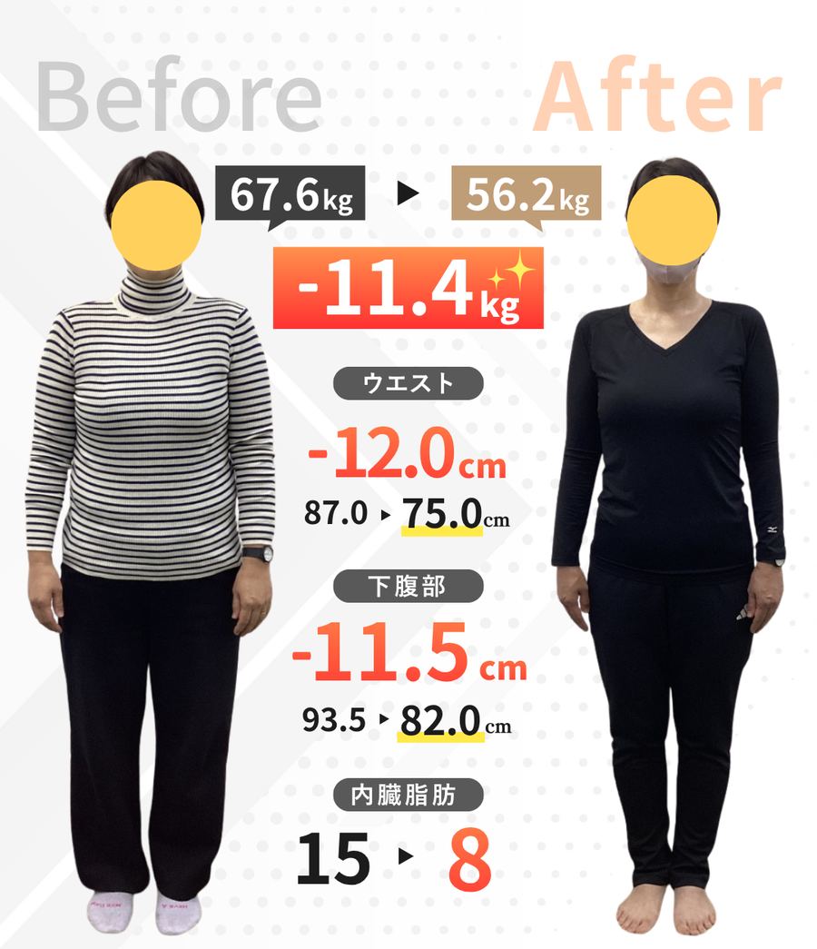 40代女性・3ヶ月のビフォーアフター（正面）